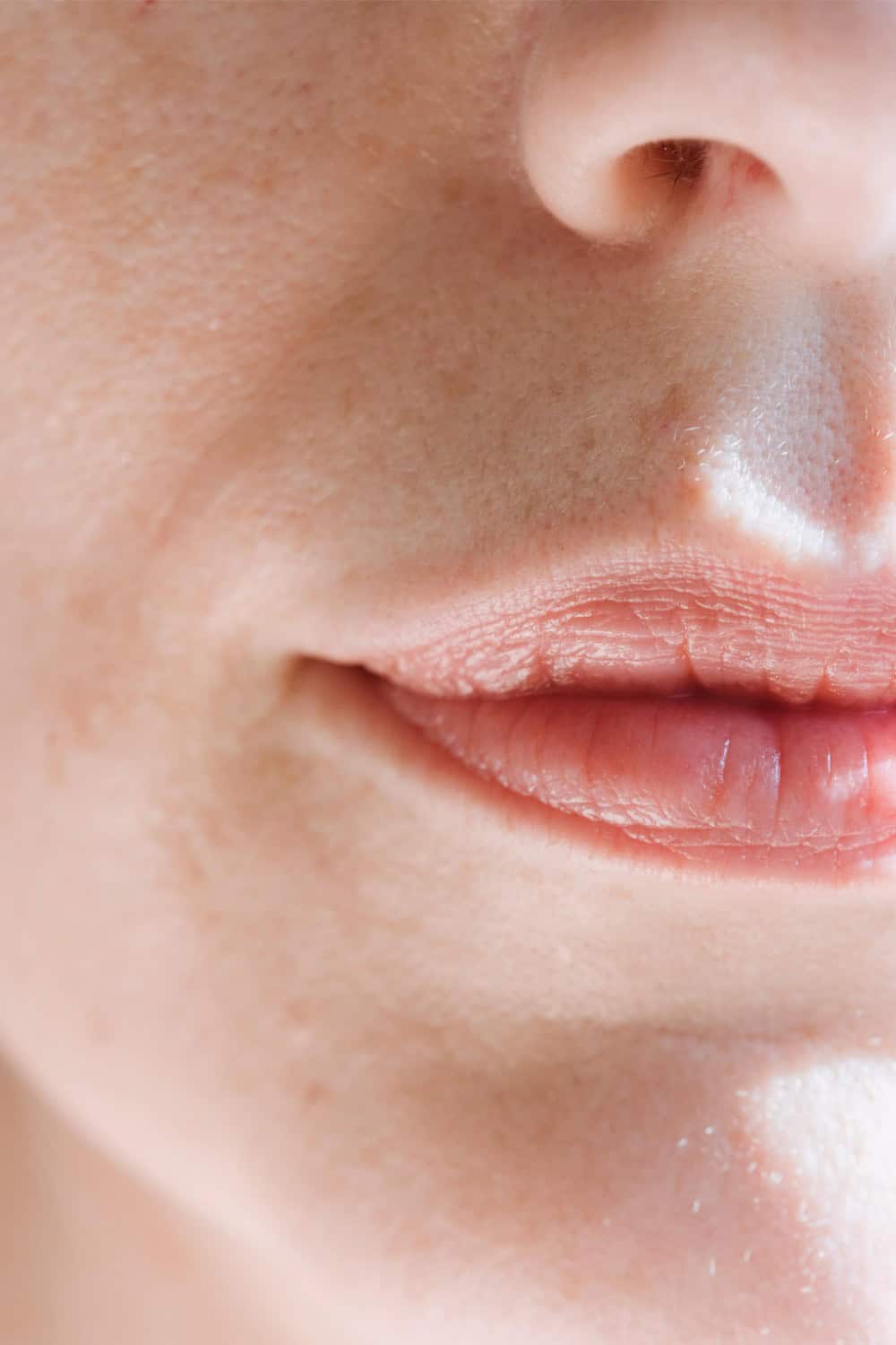 The Best Lip Balm for Accutane